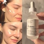 سرم آبرسان اوردینری Hyaluronic Acid