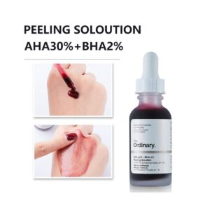سرم لایه بردار اوردینری Peeling Solution