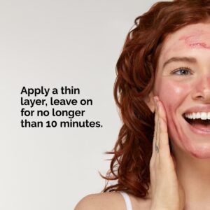 سرم لایه بردار اوردینری Peeling Solution