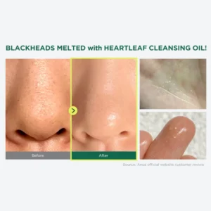 روغن پاک کننده منافذ آنوا Heartleaf