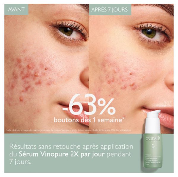 سرم سالیسیلیک اسید کدلی Vinopure