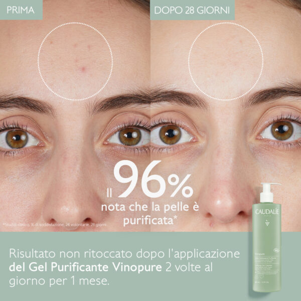 ژل شستشو ضد جوش کدلی Vinopure حجم 385میل