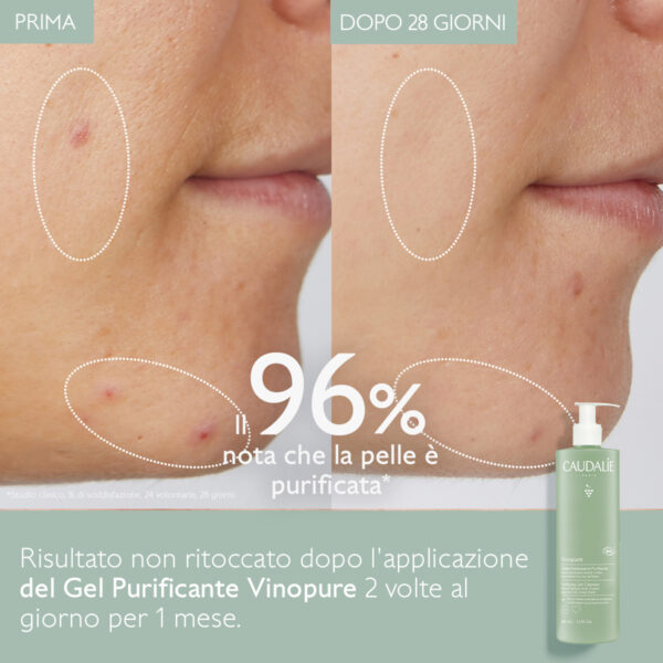 ژل شستشو ضد جوش کدلی Vinopure حجم 385میل