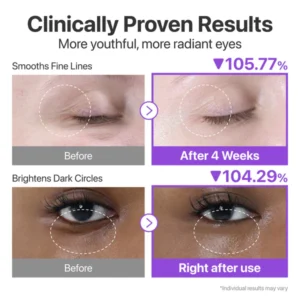 کرم دور چشم نامبوزین شماره 9 رتینول و NAD+ حجم 10 میل