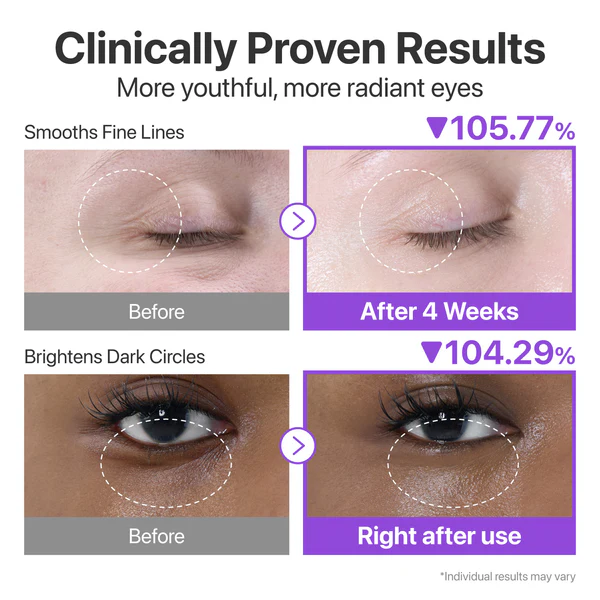 کرم دور چشم نامبوزین شماره 9 رتینول و NAD+ حجم 10 میل