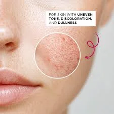 سرم Perfect Bright اولاین روشن کننده و ضد لک Perfect Bright حجم 30 میل