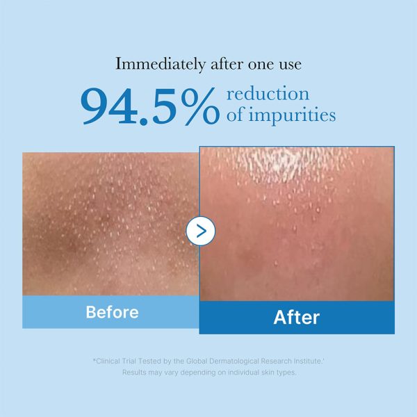 روغن پاک‌کننده آرایش صورت مدیکیوب مدل blackhead deep حجم 205 میل