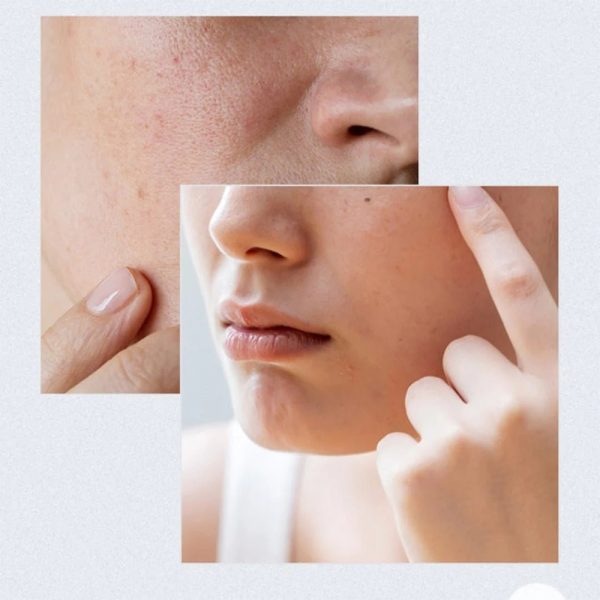 پد تقویت کننده مرطوب کننده آنوا Birch Moisture حجم 160 میل