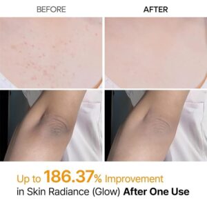 اسپری Peel Shot دکتر‌ملاکسین ضدلک و لایه‌بردار بدن 200 میل