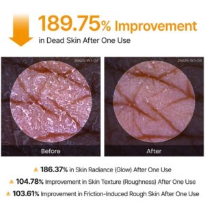 اسپری Peel Shot دکتر‌ملاکسین ضدلک و لایه‌بردار بدن 200 میل